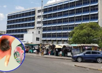 siete muertes por hongo negro en honduras en 2025 incluida una nina de tres anos