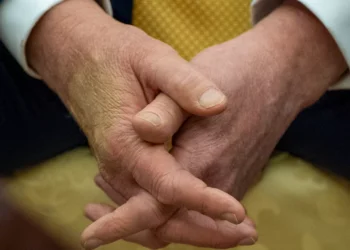 Trump es diagnosticado con “insuficiencia venosa crónica”